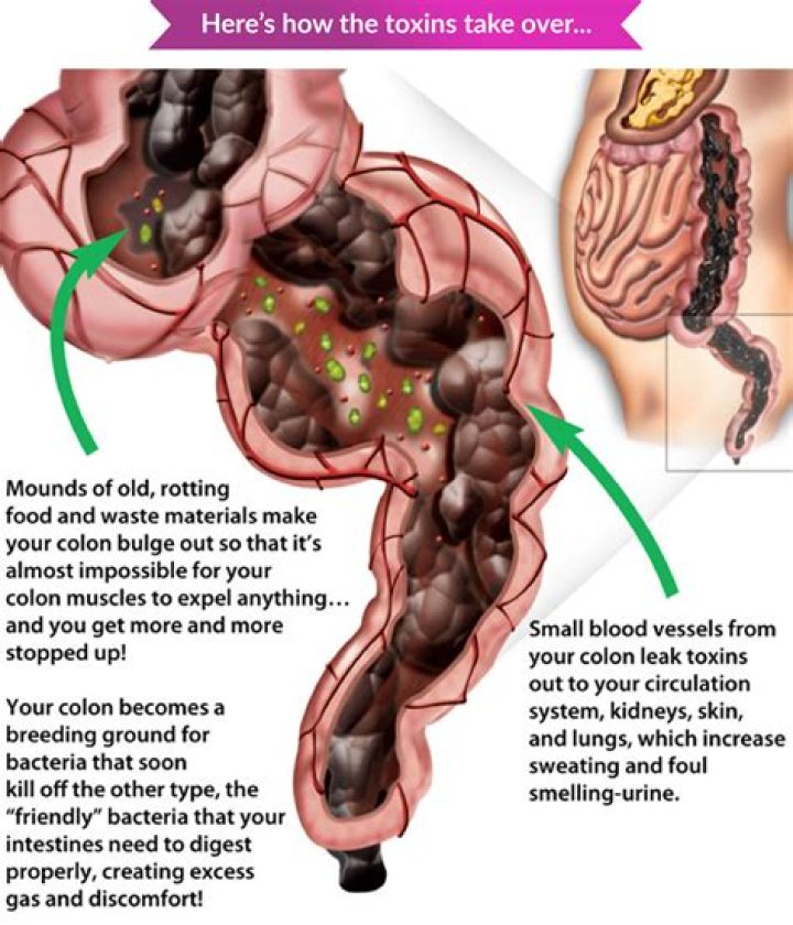 How do I stop my intestines from hurting?