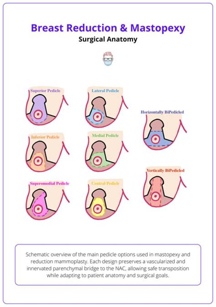 How long does a reduction mammoplasty take?