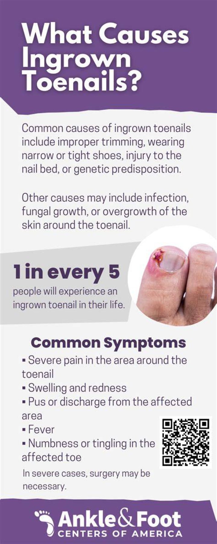 What should I do if my toddler has an ingrown toenail?